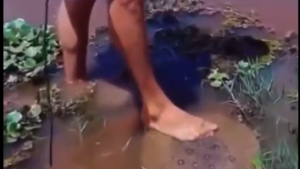 Tourist is stinged by A Dangerous Fish